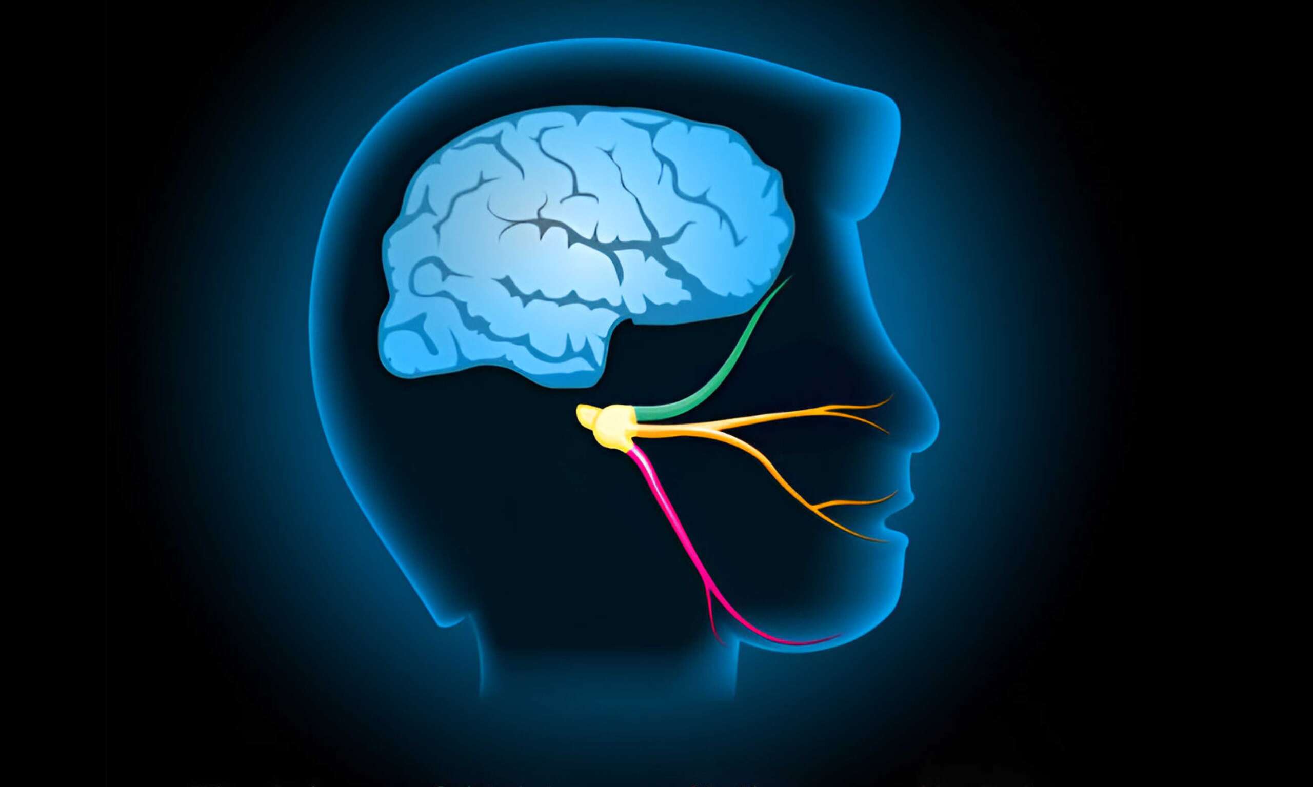 Trigeminal Nevralji